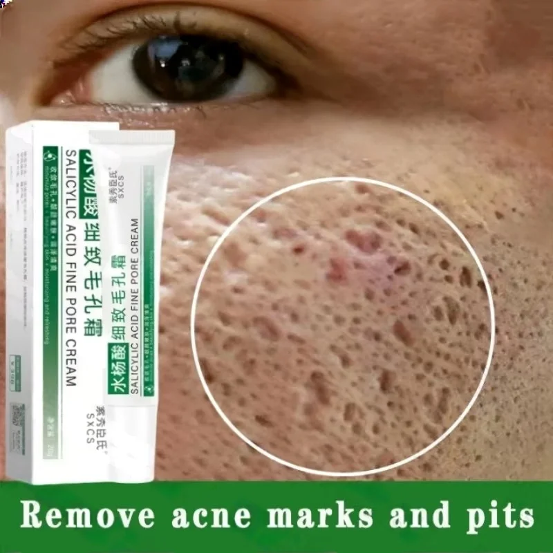 Korean Skincare Routine - Salicylzuur Porie Clearing Cream Krimpen Poriën