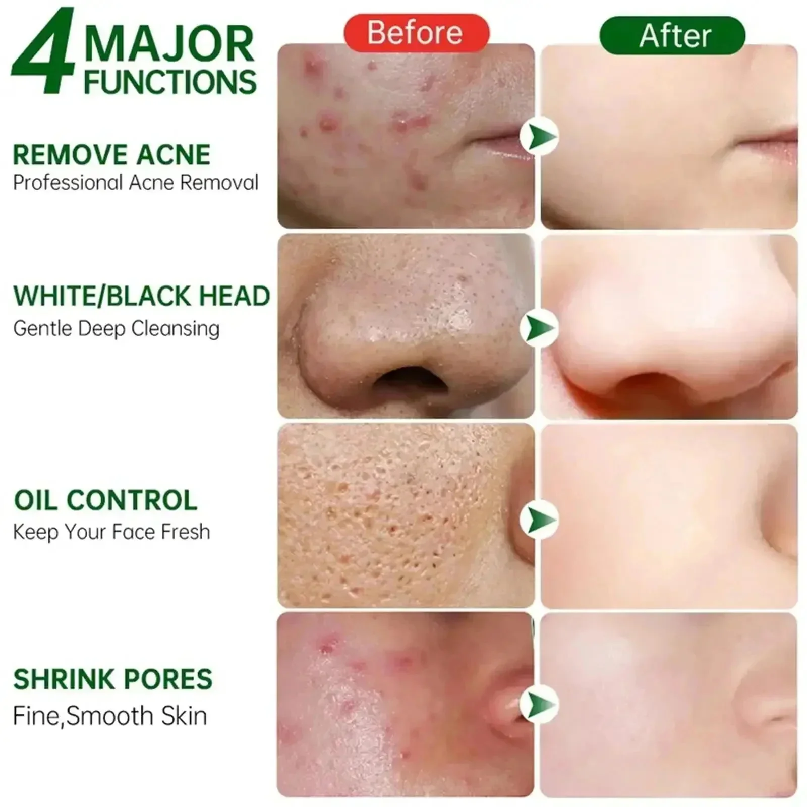 Salicylzuur Porie Clearing Cre - Korean Skincare Routine recensie en prijs