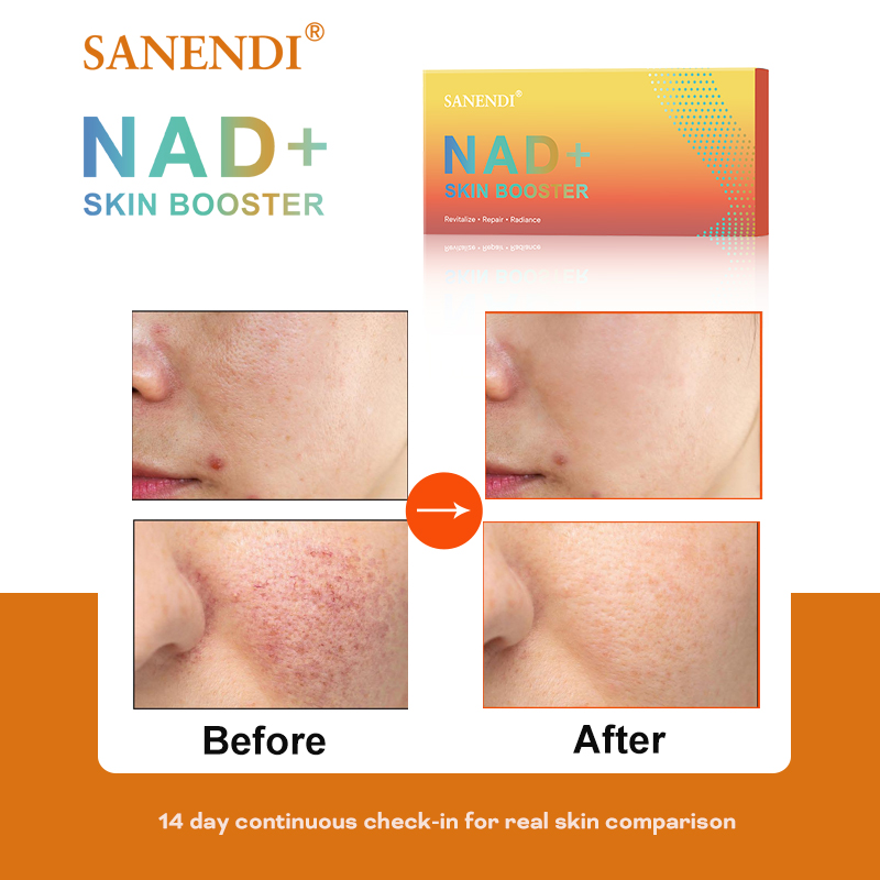 Sanendi NAD+ Korea Huidverzorg - Korean Skincare Routine recensie en prijs