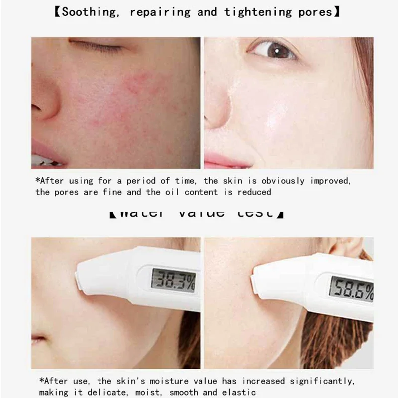 30pcs Centella Collageen Slape - Korean Skincare Routine recensie en prijs